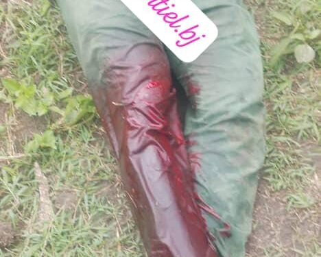 Tensions agriculteurs-éleveurs dans le Zou: Un agriculteur blessé par un berger à Zogbodomey